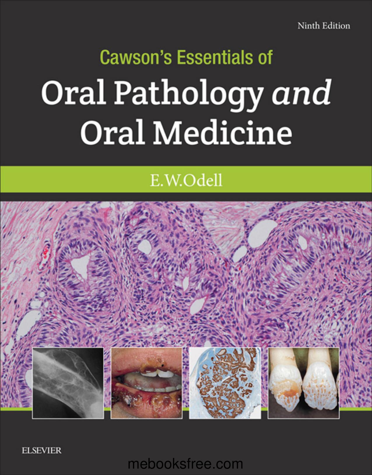 Cawson’s Essentials of Oral Pathology and Oral Medicine 2017