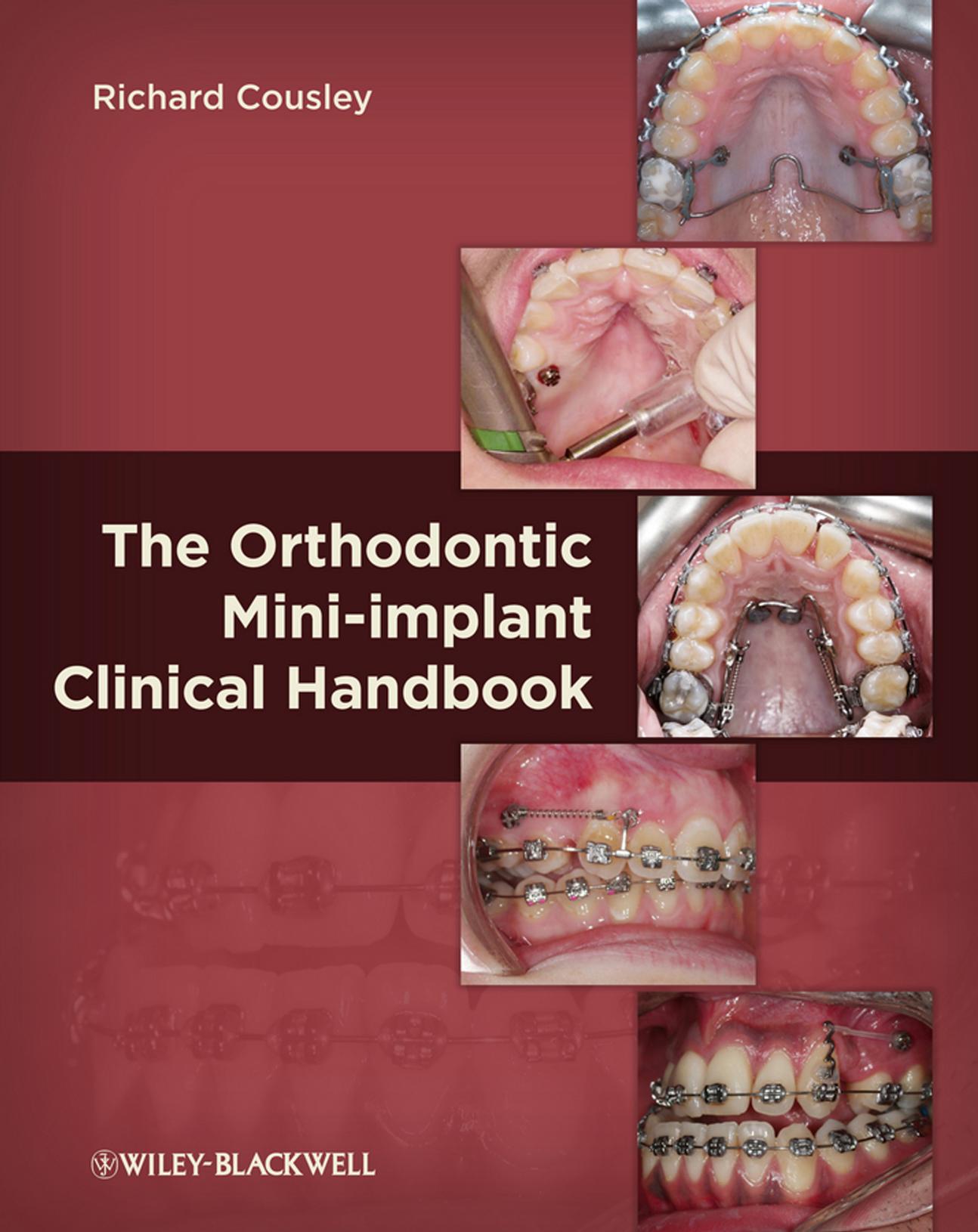 The Orthodontic Mini-implant Clinical Handboo
