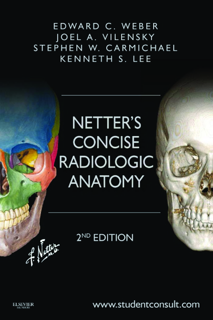 Netter's Concise Radiologic Anatomy: With STUDENT CONSULT Online Access