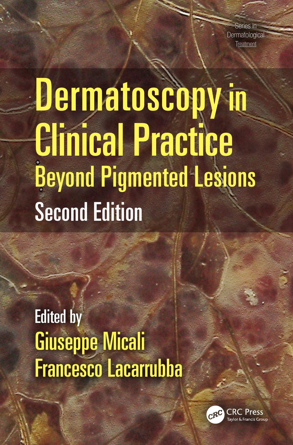 Dermatoscopy in Clinical Practice: Beyond Pigmented Lesions