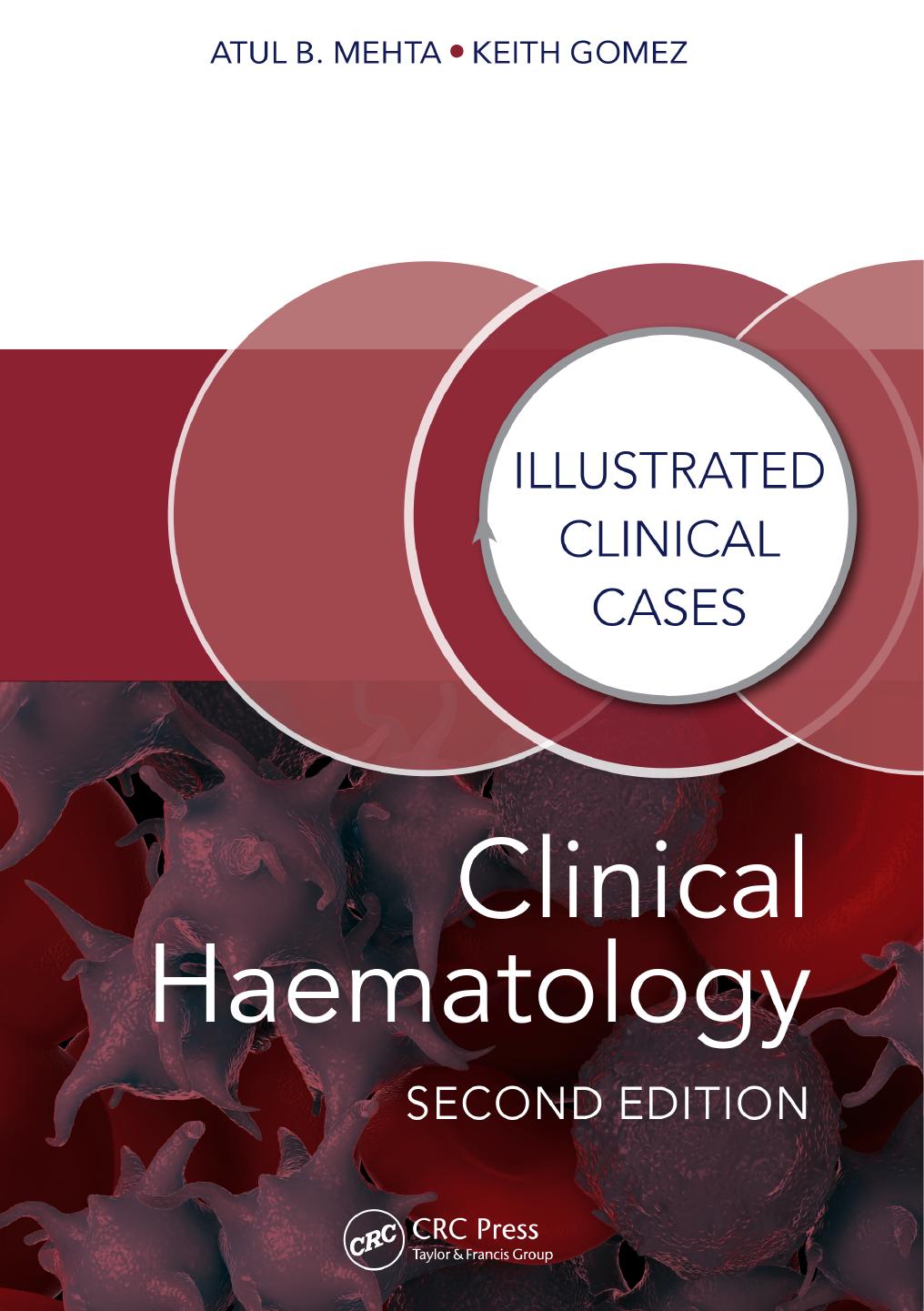 Clinical Haematology, Second Edition