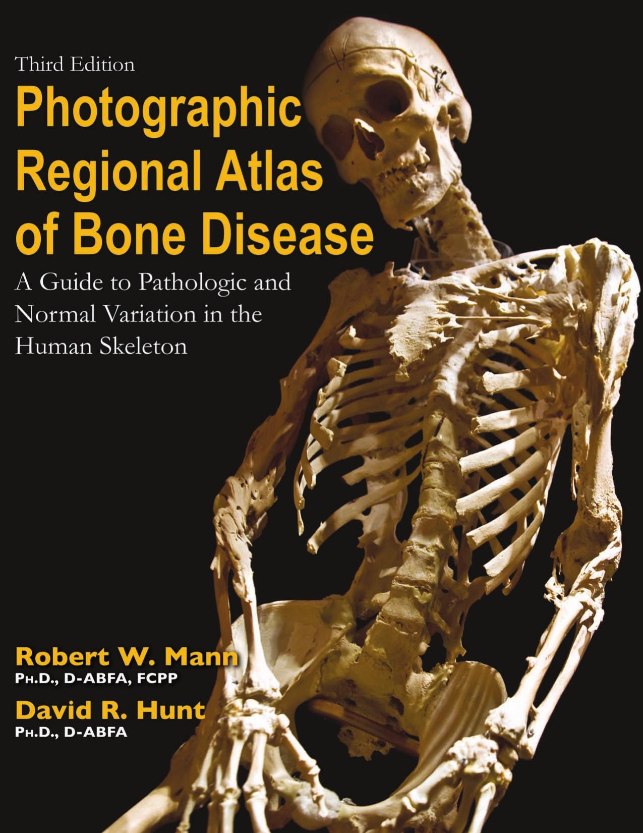 Photographic Regional Atlas of Bone Disease