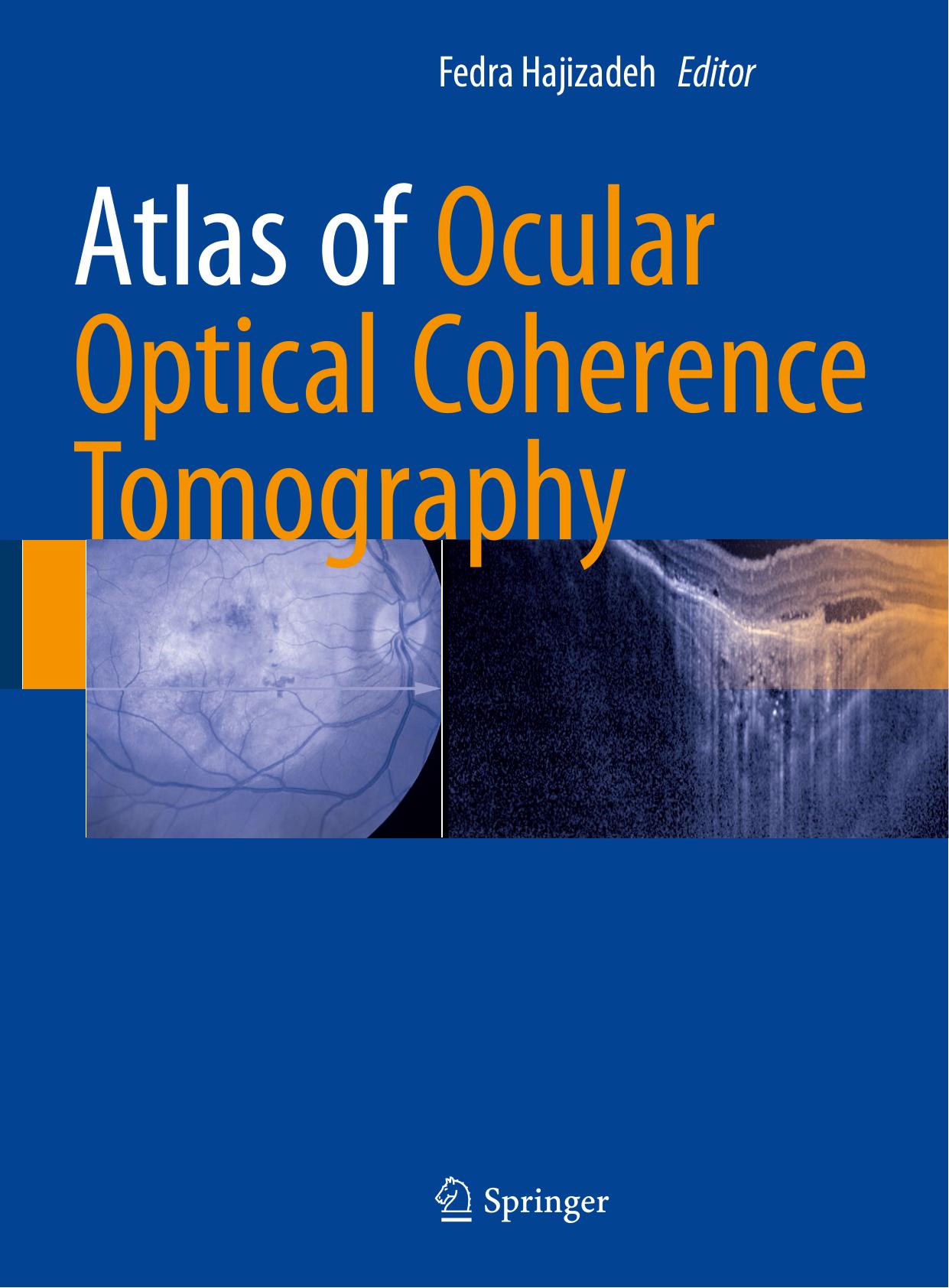 Atlas of Ocular Optical Coherence Tomography, 2018