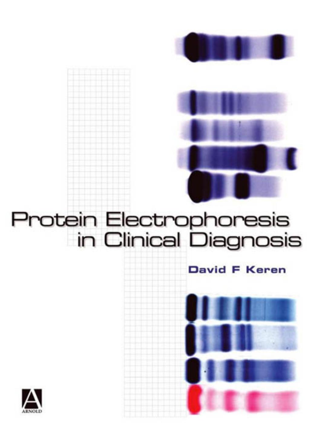 Protein Electrophoresis in Clinical Diagnosis