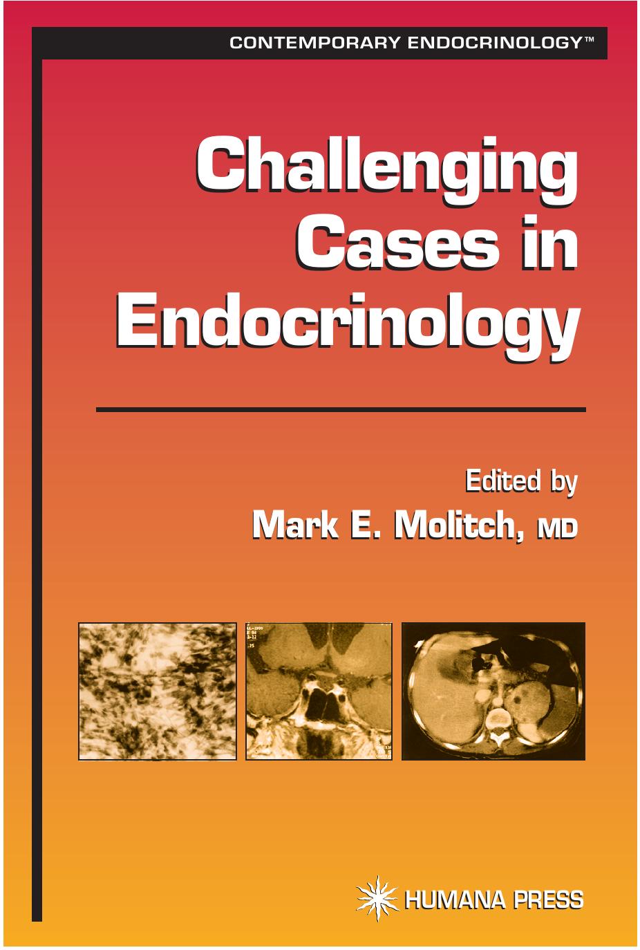 CHALLENGING CASES IN ENDOCRINOLOGY 2002