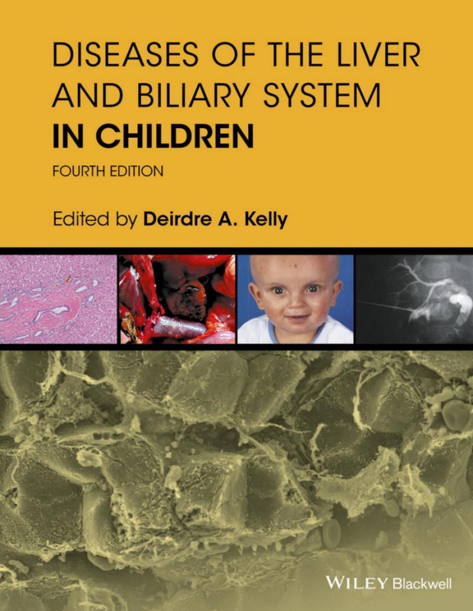 DISEASES OF THE LIVER AND BILIARY SYSTEM IN CHILDREN 4th ed 2017