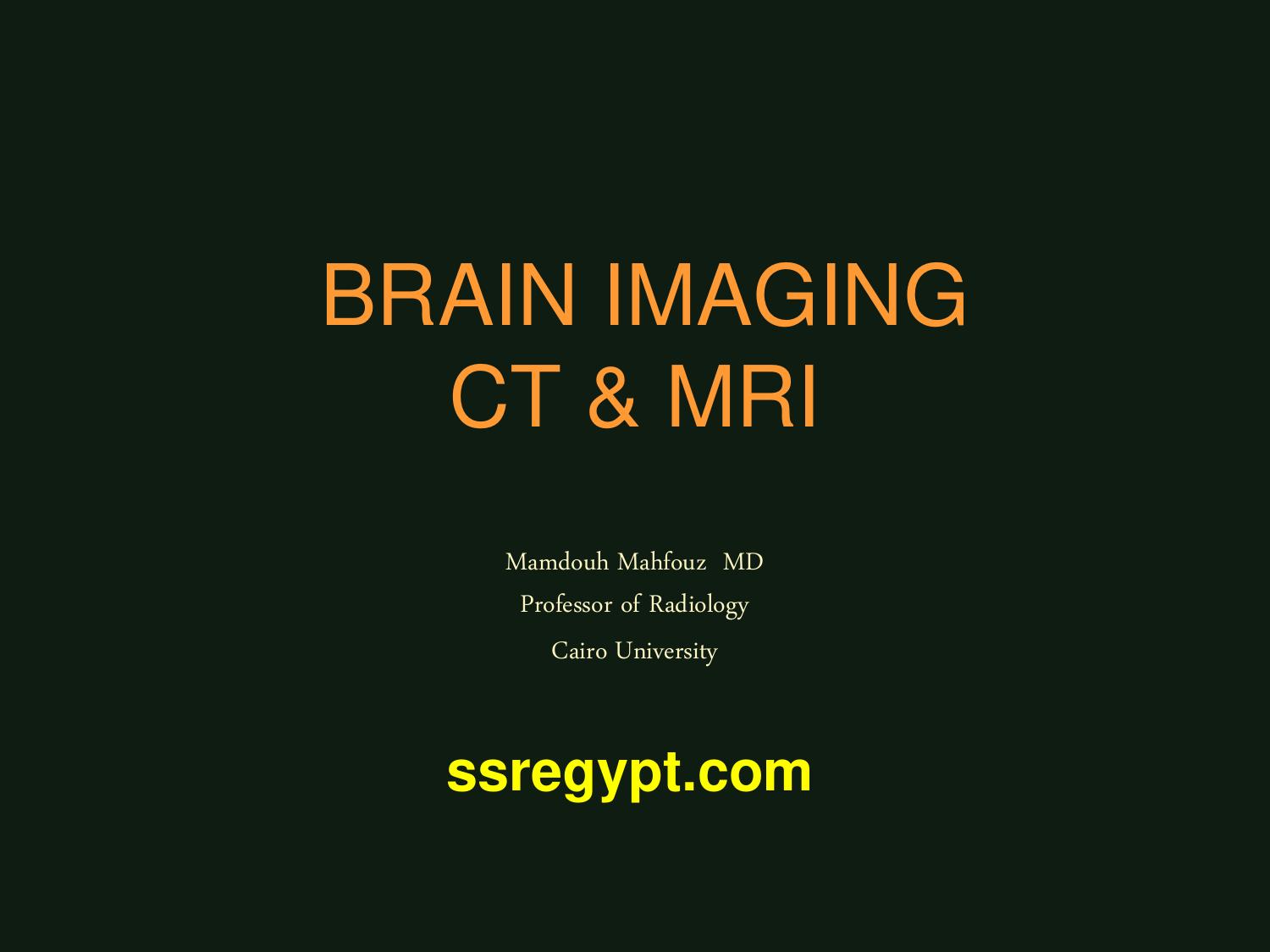 CT BRAIN SCAN  Mamdouh Mahfouz  MD Professor of Radiology Cairo University