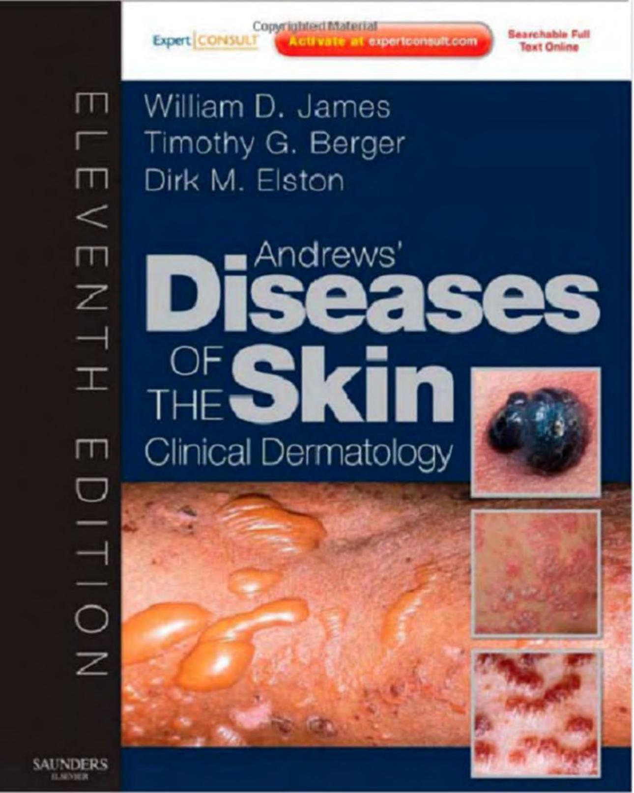 Andrews' Diseases of the Skin  Clinical Dermatology