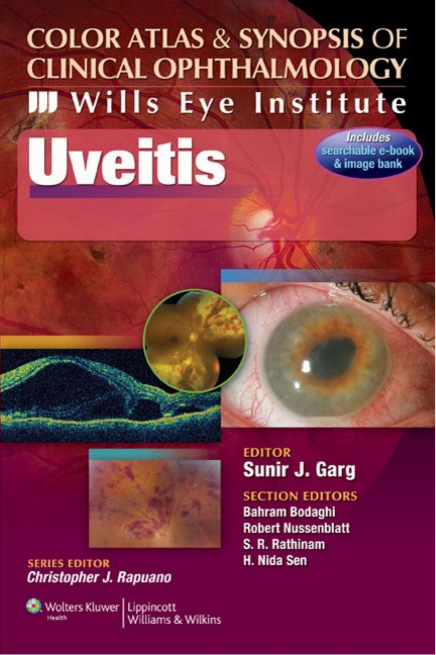 Color Atlas & Synopsis of Clinical Ophthalmology - Wills Eye Institute Uveitis-