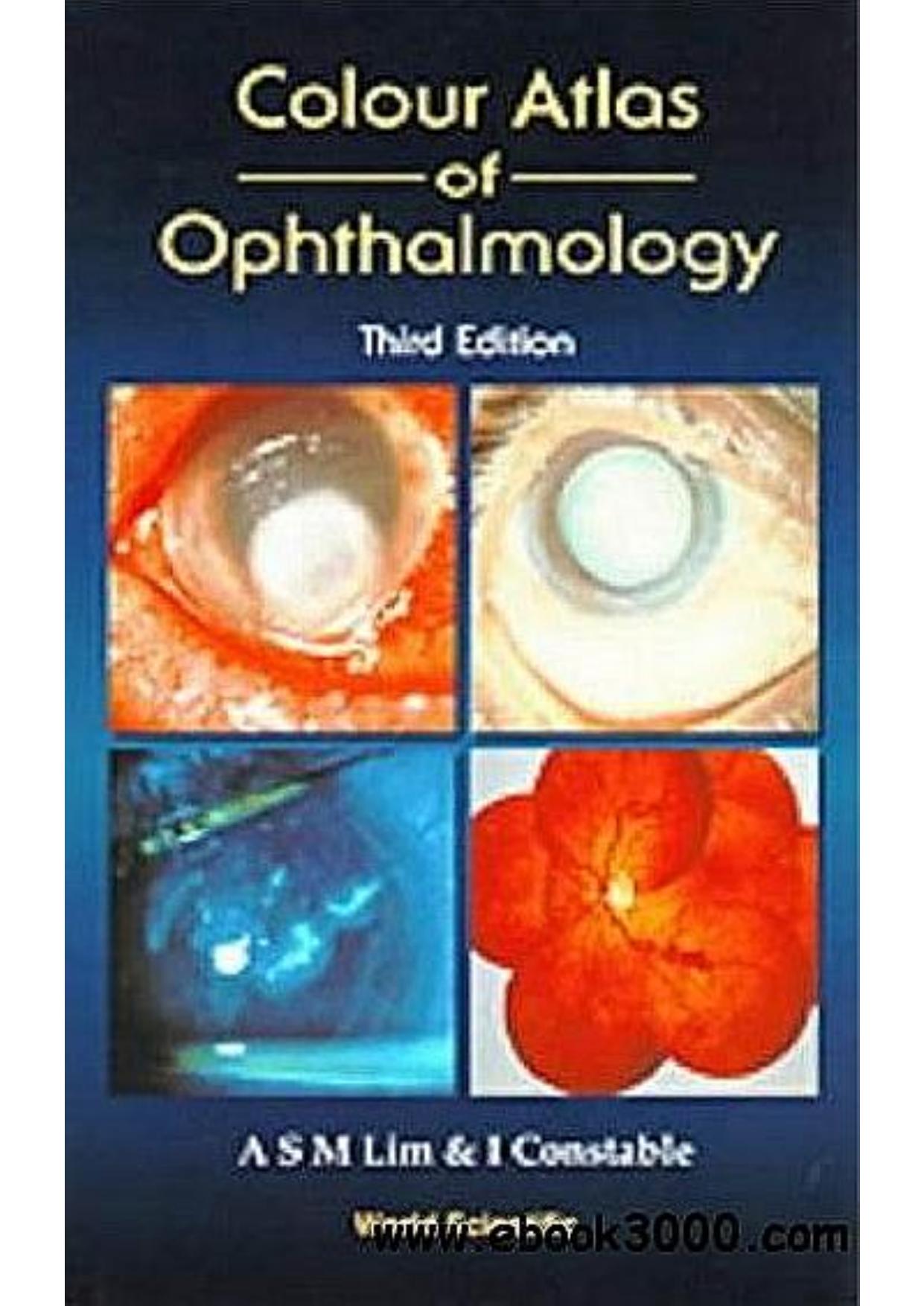 Colour Atlas of Ophthalmology (3rd Ed.)