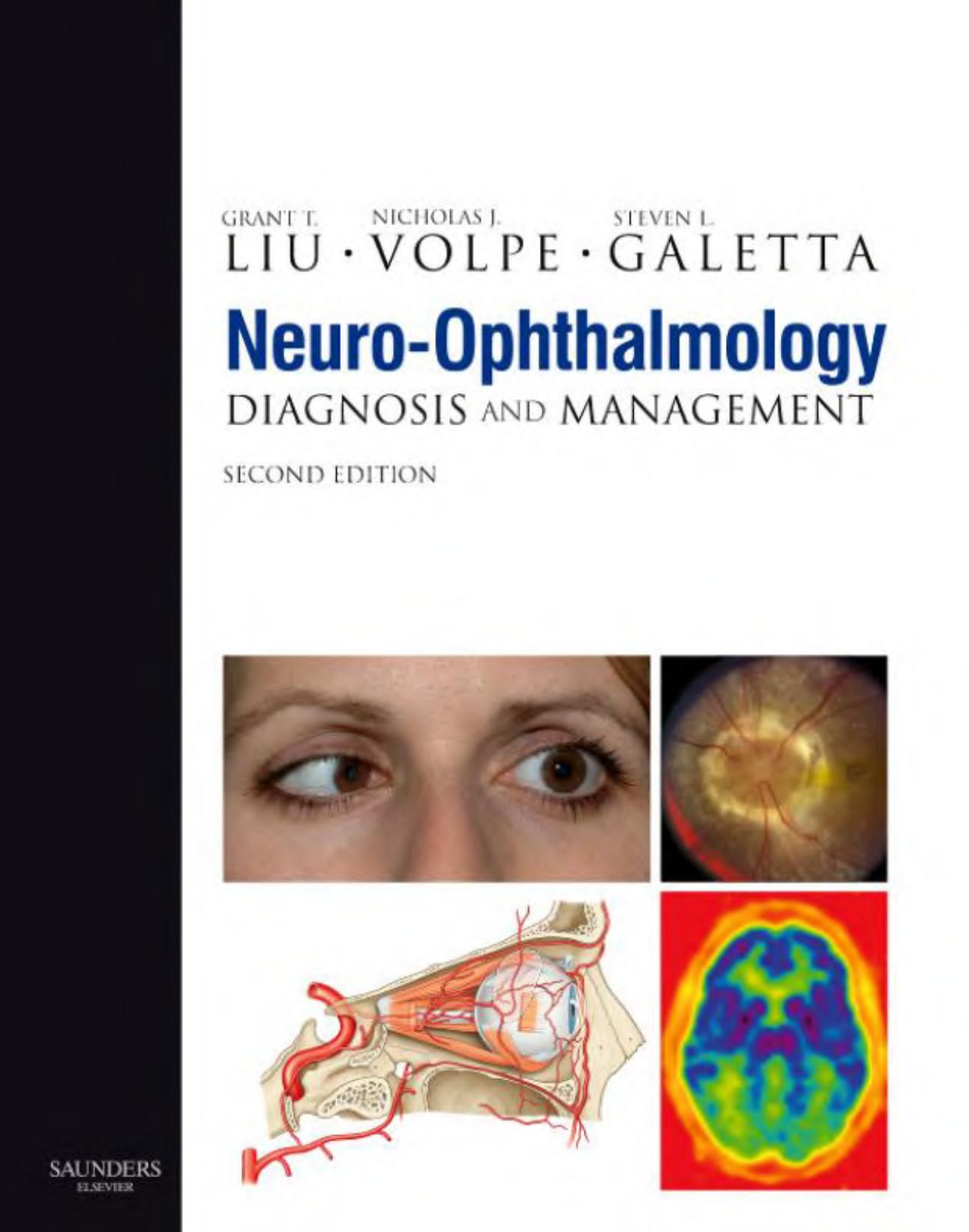 Neuro-Ophthalmology: Diagnosis and Management