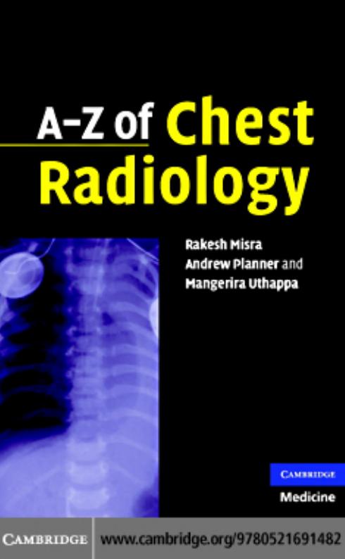 A–Z of Chest Radiology ( PDFDrive.com )