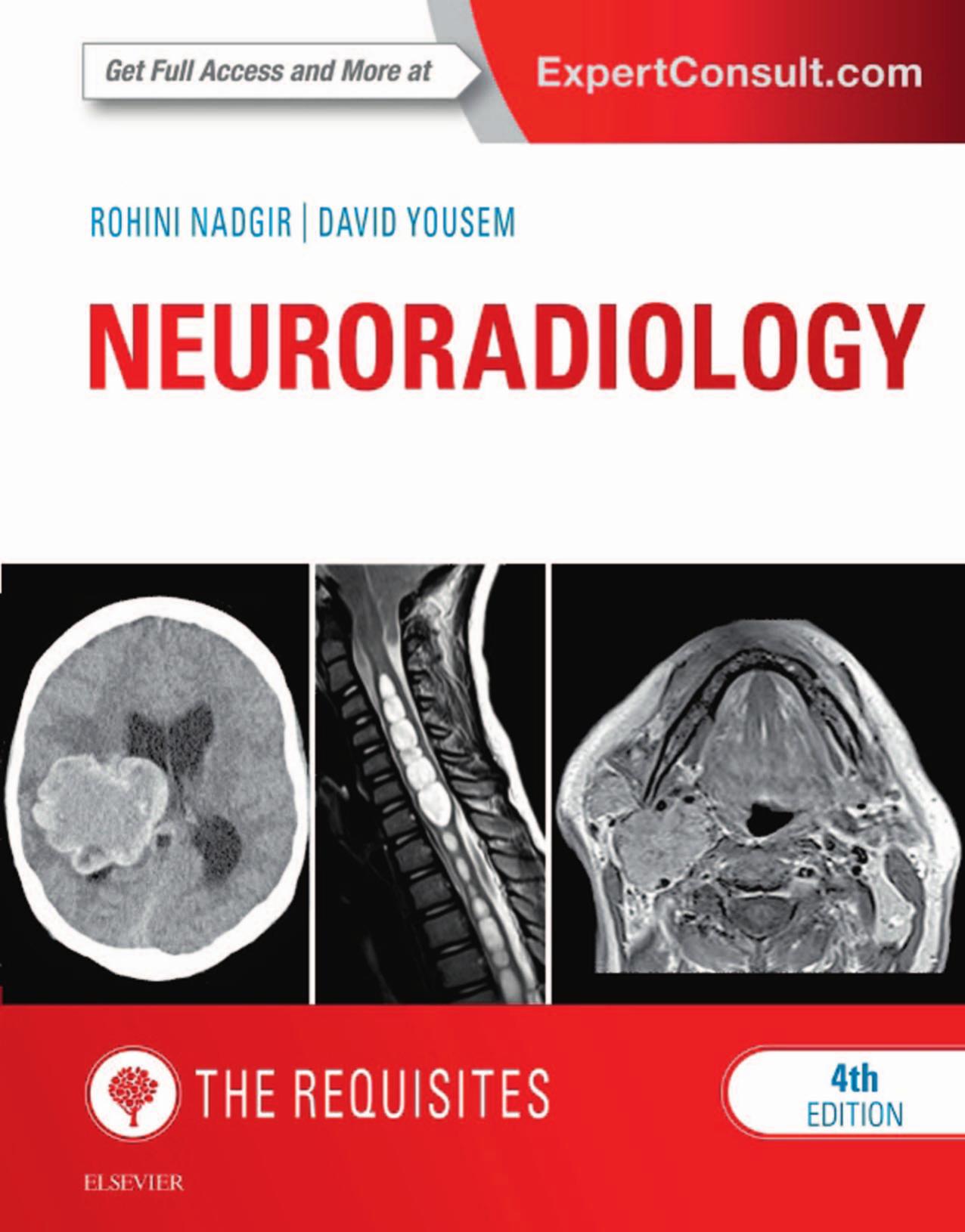 Neuroradiology  The Requisites ( PDFDrive.com )