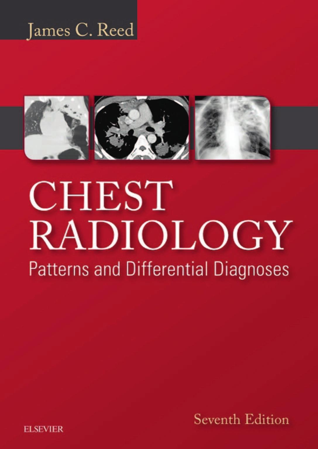 Chest Radiology: Patterns and Differential Diagnoses