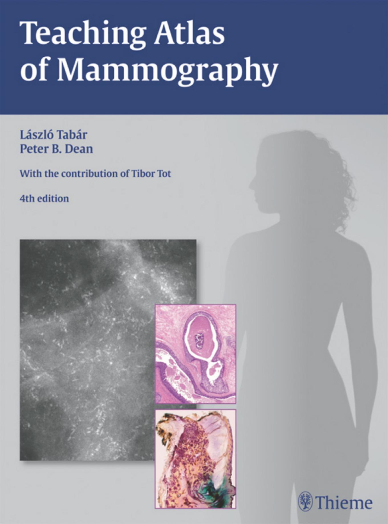 Teaching Atlas of Mammography, 4th Edition