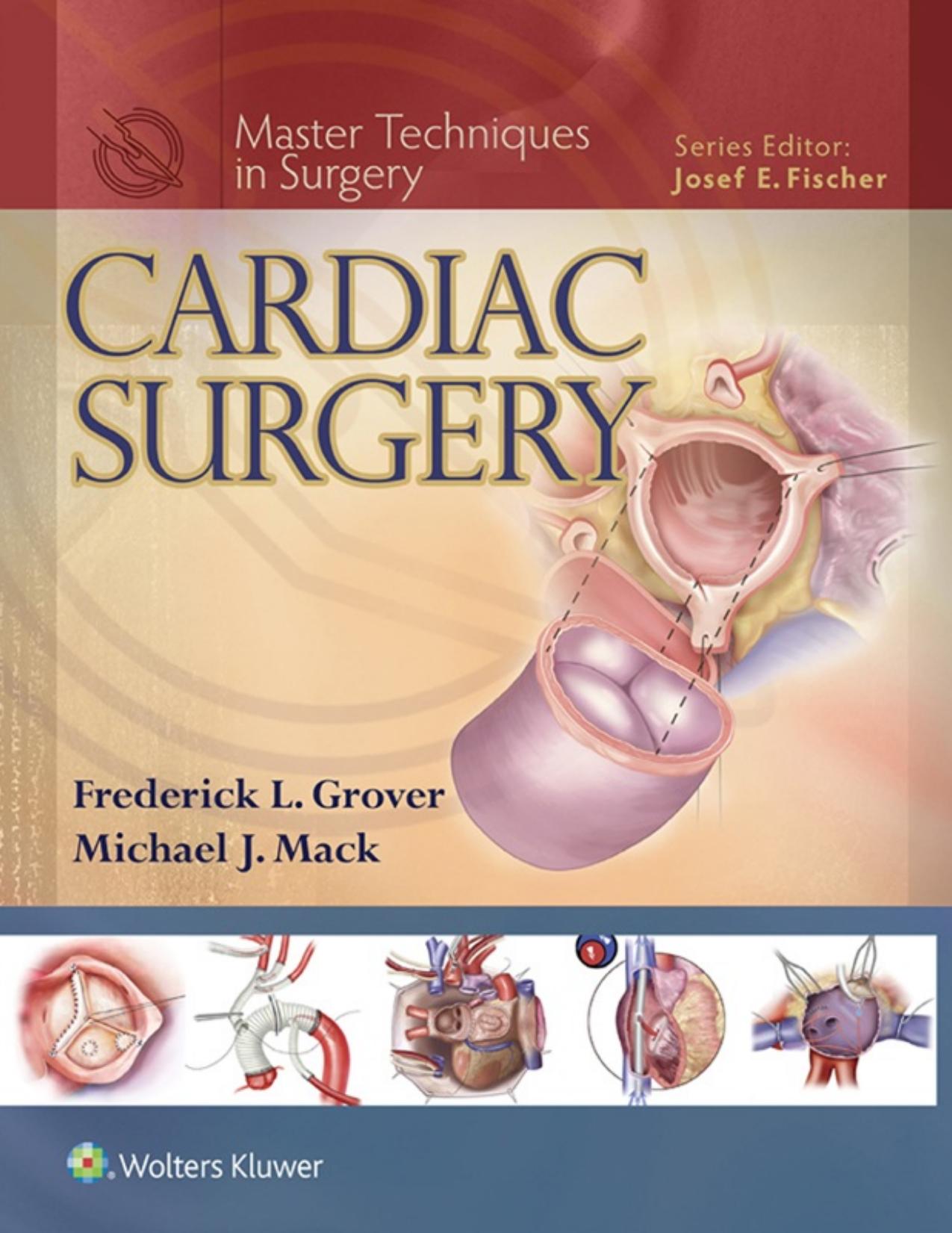 Master Techniques in Surgery: Cardiac Surgery - PDFDrive.com