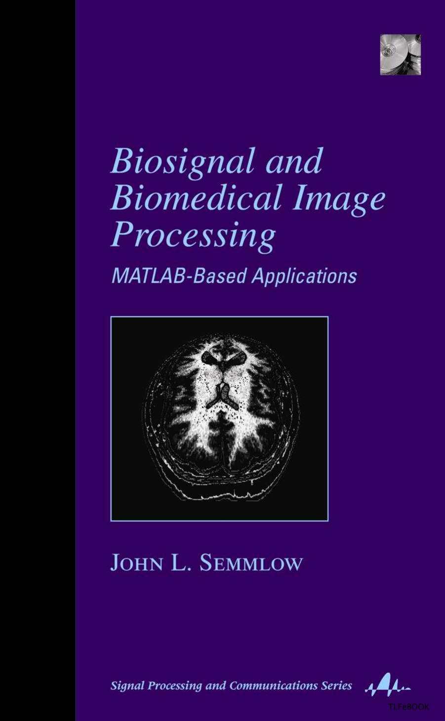 [John L. Semmlow] Biosignal and Medical Image Proc(b-ok.cc)